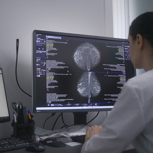 România face pași importanți în adoptarea inteligenței artificiale în medicină, conform digi24.ro. Potrivit site-ului, MedLife a lansat în premieră un proiect pilot care combină AI-ul cu imagistica medicală pentru a sprijini medicii în redactarea rapoartelor. Algoritmul AI specializat învață din aproape un milion de imagini RMN și din experiența medicilor pentru a asigura acuratețea și coerența documentației medicale.